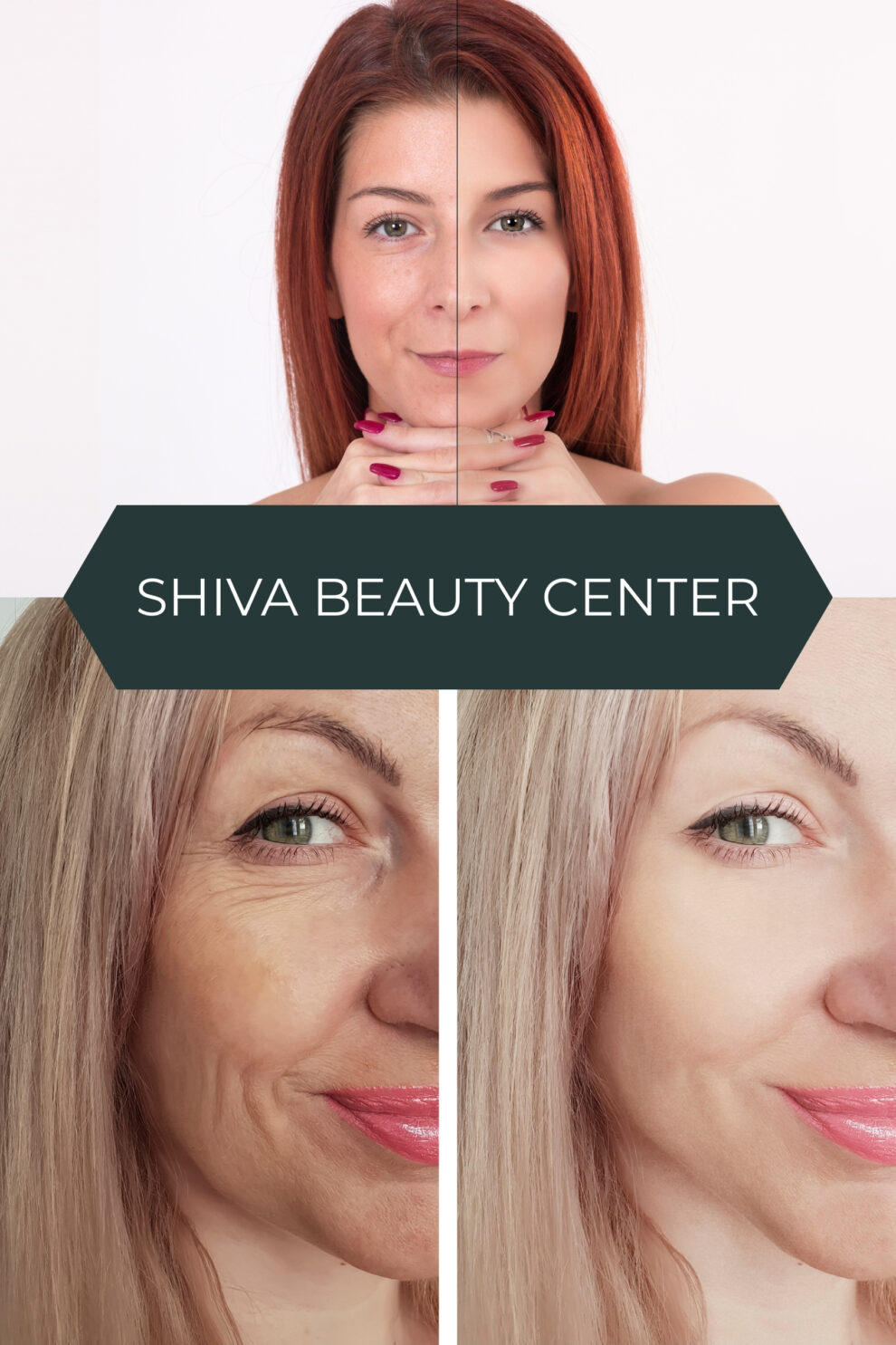 SHIVA BEAUTY CENTER (3) https://shivabeautycenter.ro/wp-content/uploads/2025/04/SHIVA-BEAUTY-CENTER-3-990x1485.jpg